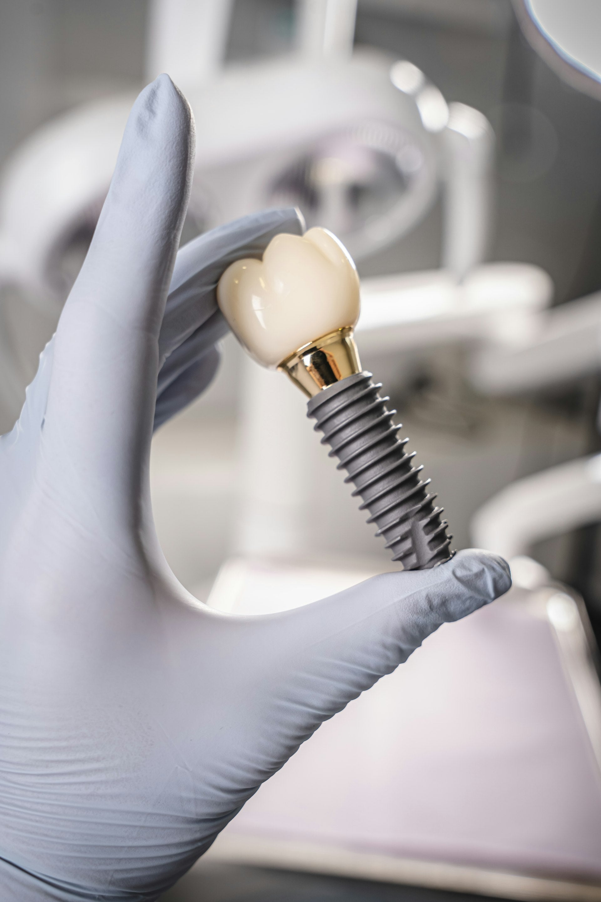 มือถือครอบฟันดิจิทัลที่ผลิตด้วยเทคโนโลยี 3D Printing