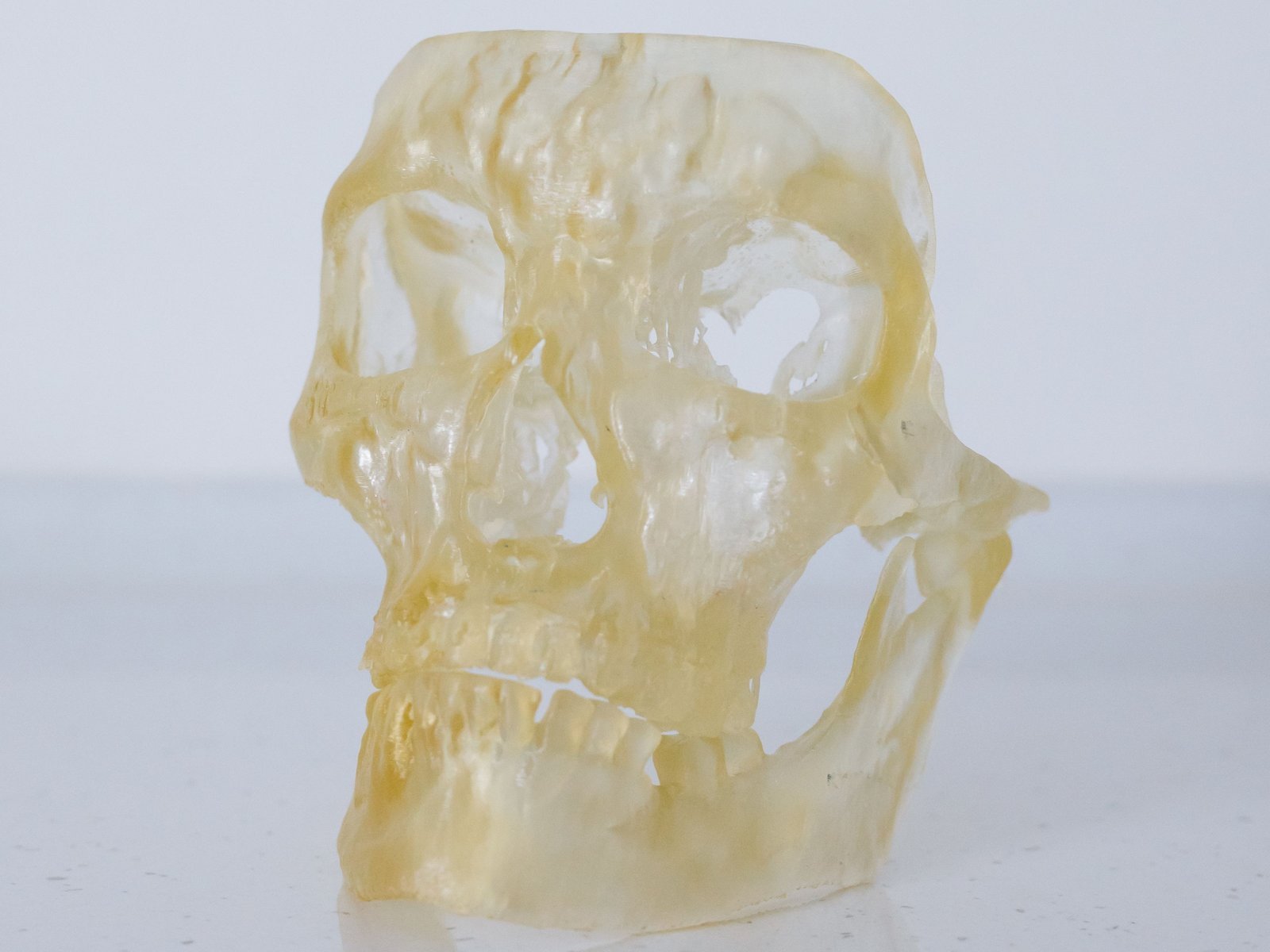 ชิ้นงานเรซิ่นโปร่งแสงรูปกะโหลกที่พิมพ์ด้วยเครื่องพิมพ์ 3D Resin